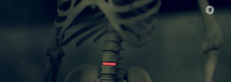 medizinprodukte (Bericht: „Das gefährliche Geschäft mit Implantaten“)